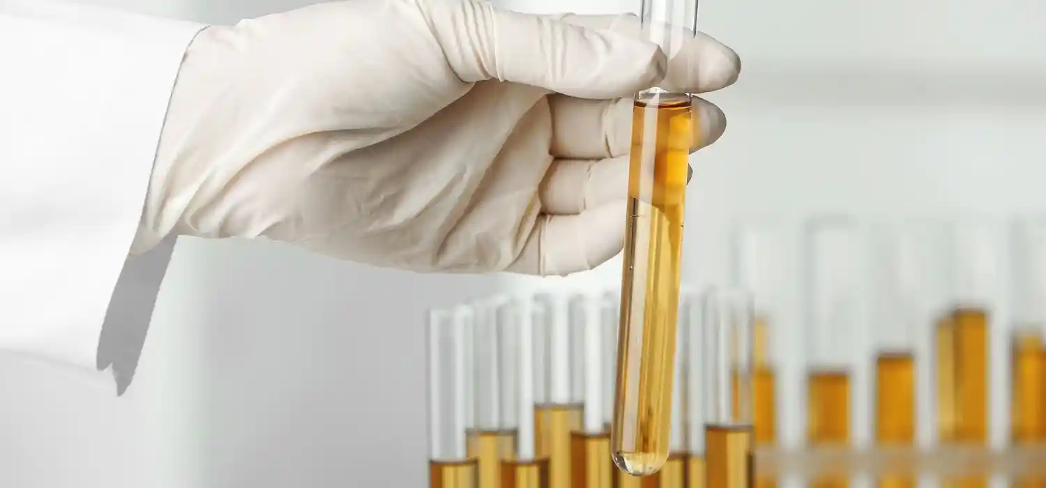 Organic Acids